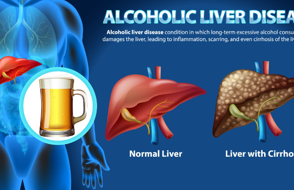 does alcohol cause inflammation