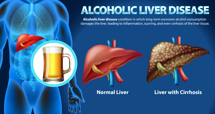 does alcohol cause inflammation
